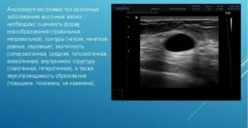 Гипоэхогенное образование в молочной железе это рак или нет