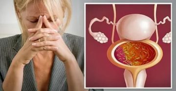 Как лечить хронический цистит при менопаузе