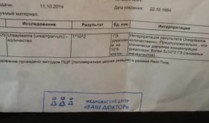 Что покажет мазок на флору при уреаплазмозе