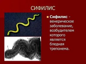 Откуда пришел сифилис