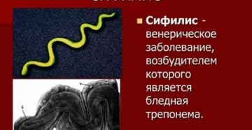 Откуда пришел сифилис