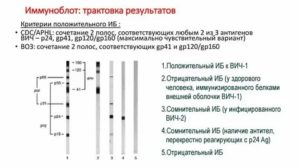 Может ли ошибаться иммуноблот на вич