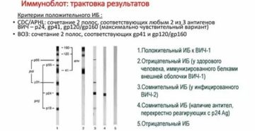 Может ли ошибаться иммуноблот на вич