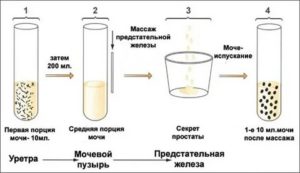 Каким должен цветом быть сок с простаты