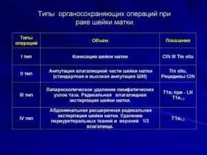 Сколько длиться операция по удалению рака шейки матки