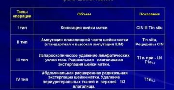 Сколько длиться операция по удалению рака шейки матки