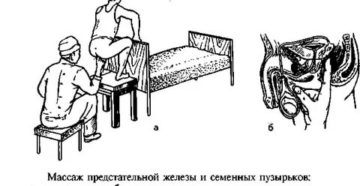 Обязательно ли делать клизму перед массажем простаты