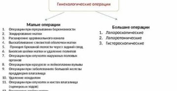 Что такое малые гинекологические операции