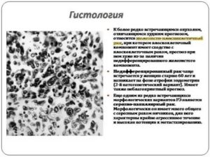 Что показывает гистология при раке эндометрия