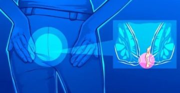 Почему во время месячных стреляет в заднем проходе у