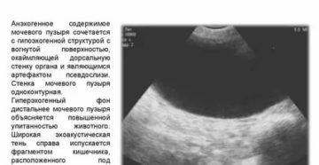 За сколько времени наполняется мочевой пузырь перед узи матки