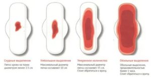 Почему месячные идут один день и обильное