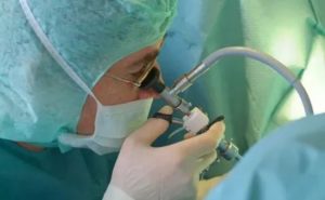 Послеоперационный период после удаления аденомы простаты в больнице и дома