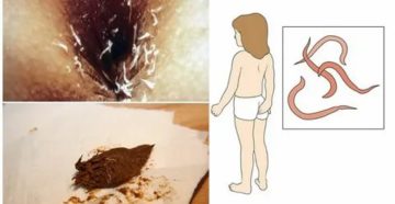 Почему перед месячными появляются острицы Почему перед месячными появляются острицы