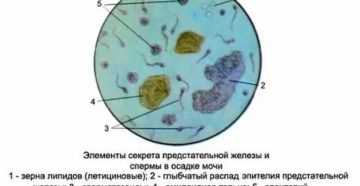 Забор секрета предстательной железы отзывы