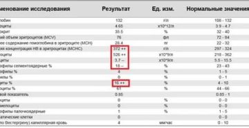 Могут ли повысится тромбоциты перед месячными