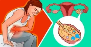 Когда месячные все тело ломает и все болит