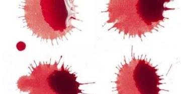 Почему у меня месячные малинового цвета