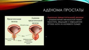 Органотропное действие на предстательную железу что это