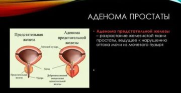 Органотропное действие на предстательную железу что это