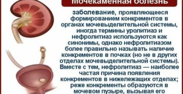 Что такое цистит и мочекаменной болезни