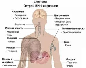 Может ли при вич болеть сердце