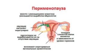 Как продлить месячные после 45 лет народными средствами