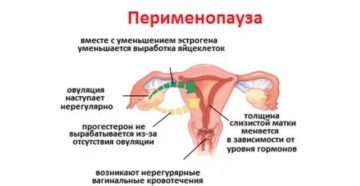 Как продлить месячные после 45 лет народными средствами Как продлить месячные после 45 лет народными средствами
