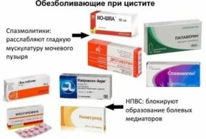 Можно ли при цистите принимать обезболивающие таблетки