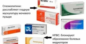 Можно ли при цистите принимать обезболивающие таблетки