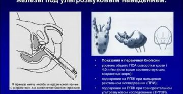 Полифокальная биопсия предстательной железы под трузи-контролем