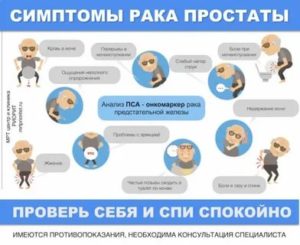 Рак простаты симптомы и признаки заболевания у мужчин симптомы