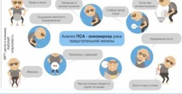 Рак простаты симптомы и признаки заболевания у мужчин симптомы