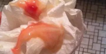 Почему месячные какие то слизистые Почему месячные какие то слизистые