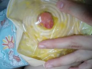 Почему у новорожденных идут месячные