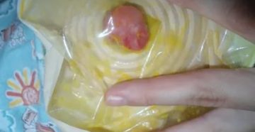 Почему у новорожденных идут месячные