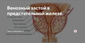 Венозный застой в предстательной железе