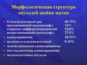 Что такое умеренно-дифференцируемый плоскоклеточный рак шейки матки