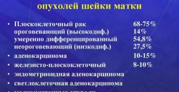 Что такое умеренно-дифференцируемый плоскоклеточный рак шейки матки