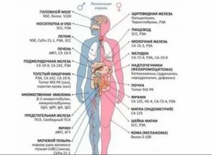 Анализ крови на онкомаркеры рака яичек