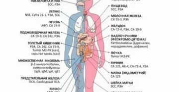 Анализ крови на онкомаркеры рака яичек