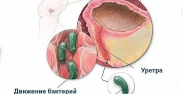 Может ли цистит или пиелонефрит передаваться половым путем