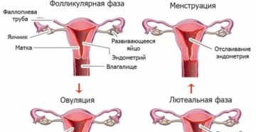 Можно ли делать чистку кишечника во время месячных