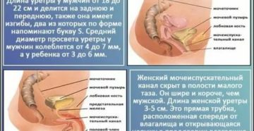Можно ли заразиться циститом от женщины через унитаз