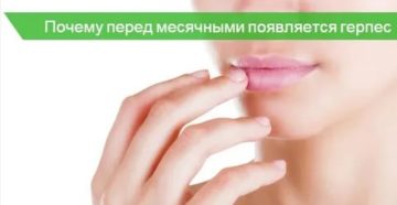 Почему обостряется герпес перед месячными Почему обостряется герпес перед месячными