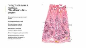 Препарат по гистологии предстательная железа