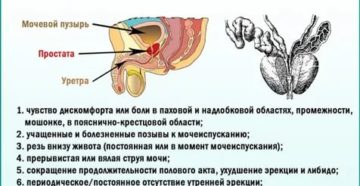Признаки заболевания предстательной железы симптомы и лечение