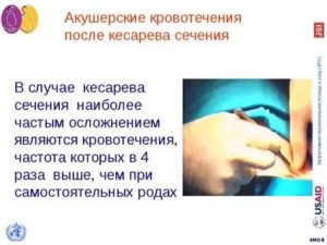 Как отличить месячные после кесарева сечения от кровотечения