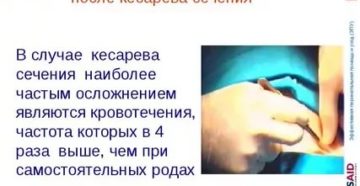 Как отличить месячные после кесарева сечения от кровотечения Как отличить месячные после кесарева сечения от кровотечения