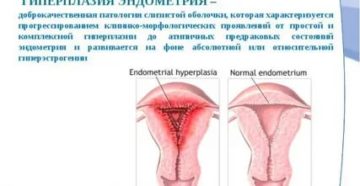 Что такое патология эндометрия при климаксе